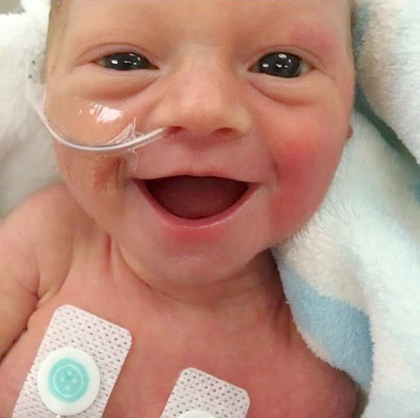 smiling-five-days-old-premature-baby-girl-photo-lauren-vinje-2