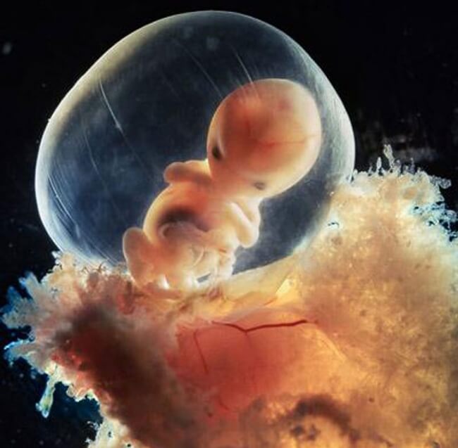 εικόνες εξέλιξης της εγκυμοσύνης