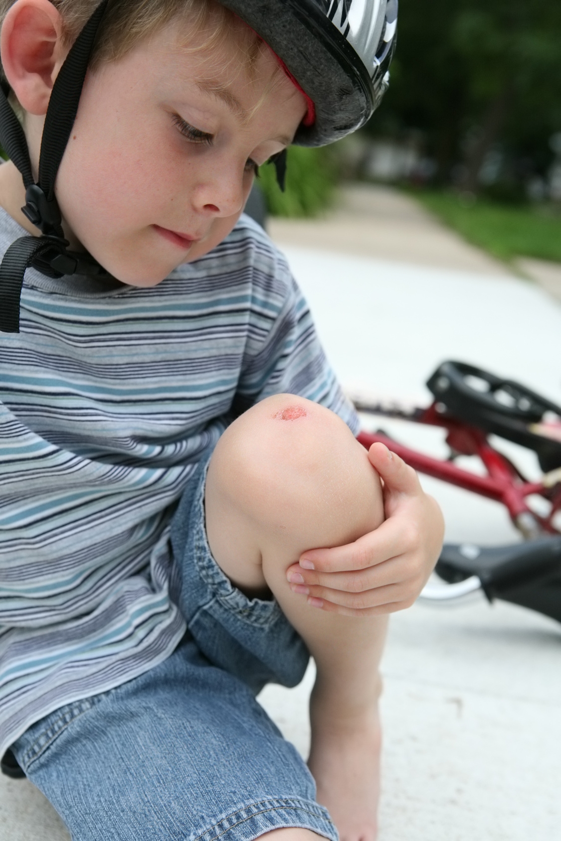 Детские травмы фф. Мальчик упал с велочэсипеоа.