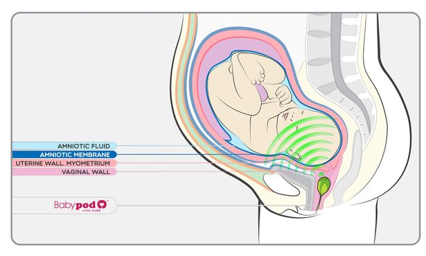 Baby-Pod-Vaginal-speaker 2