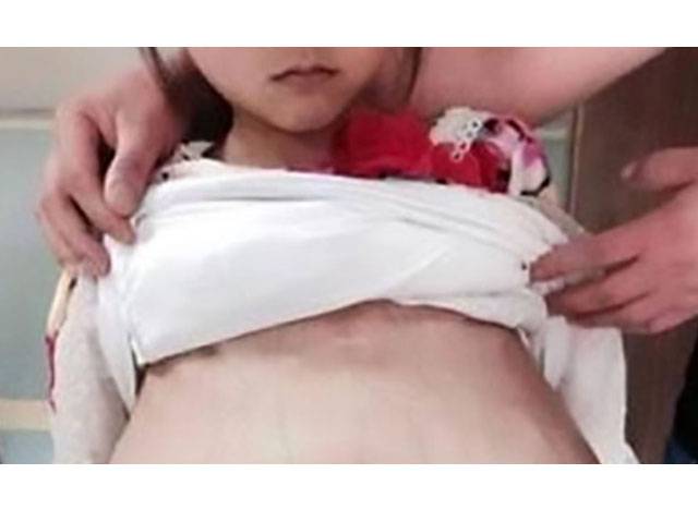 Κίνα: 40χρονος πήγε 12χρονη έγκυο στο νοσοκομείο λέγοντας πως είναι η 20χρονη σύζυγός του