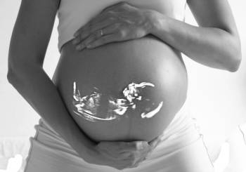 Ρευματοειδής αρθρίτιδα στην εγκυμοσύνη